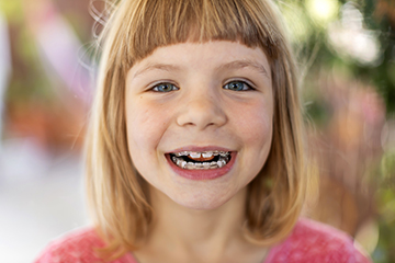 Two Phase Orthodontics in Saint James