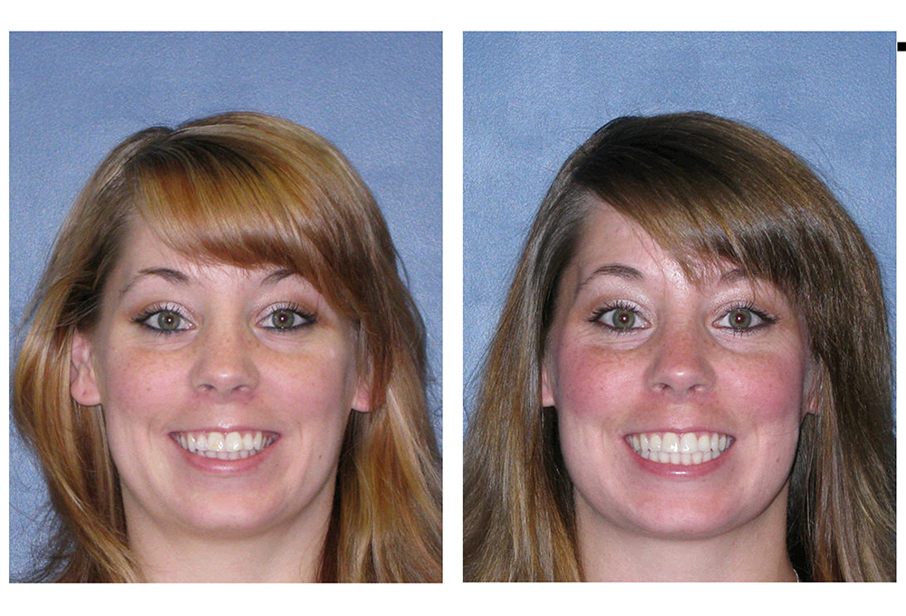 Straight Smiles Orthodontics