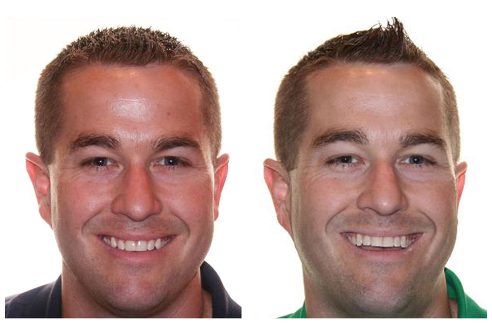 Straight Smiles Orthodontics