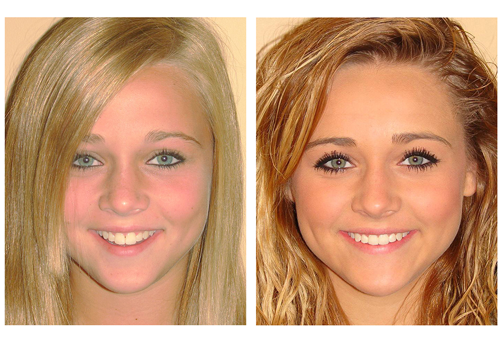 Straight Smiles Orthodontics